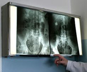Рентген легких детям и взрослым - без выходных