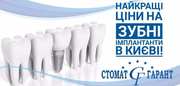 Якісна імплантація зубів у Києві 